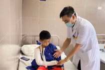 Vui chơi ngày hè, gần 50 trẻ ngã gãy lồi cầu xương cánh tay