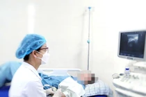 Tiêm Botulinum toxin nhóm A điều trị co cứng cơ sau đột quỵ