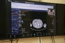 Bệnh viện Việt Đức hội chẩn từ xa cấp cứu 4 nạn nhân bị sạt lở tại Điện Biên