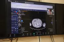 Bệnh viện Việt Đức hội chẩn từ xa cấp cứu 4 nạn nhân bị sạt lở tại Điện Biên