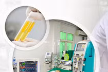 Kỳ tích hồi sinh sự sống cho trẻ mắc viêm não tủy rải rác cấp tính 