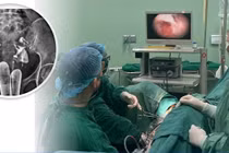 Phẫu thuật nội soi tách dính buồng tử cung cho người phụ nữ 38 tuổi