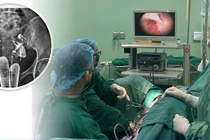 Phẫu thuật nội soi tách dính buồng tử cung cho người phụ nữ 38 tuổi