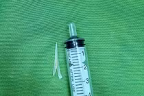 Lấy xương cá lớn 2 chạc trong thực quản người bệnh 49 tuổi