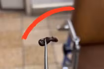 Lấy vắt sống trong mũi bệnh nhi 4 tuổi