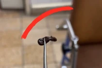 Lấy vắt sống trong mũi bệnh nhi 4 tuổi