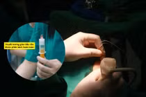 Đông cứng khớp vai... nguy cơ tàn phế