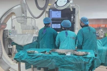 Những yếu tố nguy cơ gây tăng vỡ gan