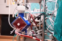 Chữa cháy tại nhà, người đàn ông ngừng tuần hoàn