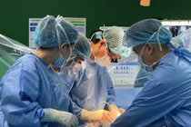 Vợ hiến gan cứu chồng 53 tuổi bị ung thư gan