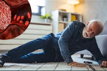 Nguy cơ ngã ở người cao tuổi, thuốc chống huyết khối có còn phù hợp?