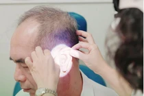 2 năm không dám mổ ung thư tai vì sợ tổn thương não, liệt dây thần kinh VII