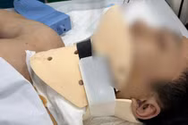 Nỗ lực phi thường cứu nam thanh niên bị chém đứt mạch máu cổ