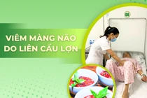Ăn tiết canh, người đàn ông viêm màng não do liên cầu lợn