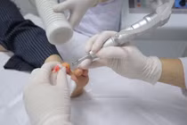 Ứng dụng công nghệ laser CO2 điều trị một số bệnh da liễu