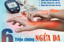 Biểu hiện trên da cảnh báo bệnh đái tháo đường
