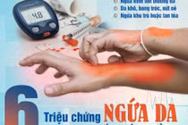 Biểu hiện trên da cảnh báo bệnh đái tháo đường