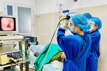 Ho, đau ngực người phụ nữ không ngờ hạt hồng xiêm mắc sâu ở thùy phổi