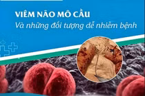 Nguy cơ bùng phát viêm não mô cầu trong cộng đồng, cách gì ngăn ngừa?