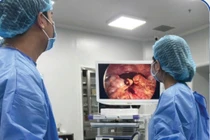 Bay gần 7 tiếng về Việt Nam cấp cứu vỡ khối chửa ngoài tử cung