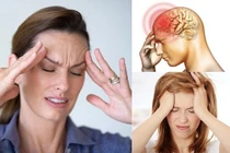 Đau nửa đầu Migraine tiềm ẩn nguy cơ đột quỵ não