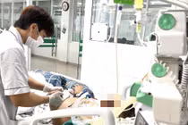 Nguy kịch vì nấm Aspergillus tấn công phổi sau cúm A