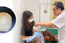 Đi qua đường, trẻ hơn 3 tuổi bị xe tông chấn thương sọ não