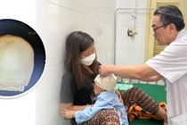 Đi qua đường, trẻ hơn 3 tuổi bị xe tông chấn thương sọ não