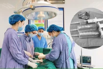 Lấy u buồng trứng phức tạp ở người bệnh đã cắt tử cung