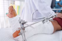 1 tuần 2 trường hợp đứt lìa cổ chân do máy cắt cỏ, cách để cứu chi