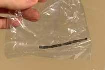 Phát hiện 24 viên nam châm rỉ sét trong bụng bé trai 3 tuổi