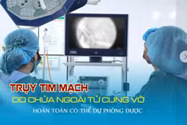 Cứu sản phụ chửa ngoài tử cung trụy mạch