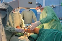 Kéo dài chi cho trẻ bị thiểu xương mác cải thiện dáng đi