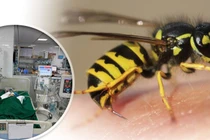 Bé gái 9 tuổi ở Nghệ An nguy kịch vì ong vò vẽ đốt dày đặc