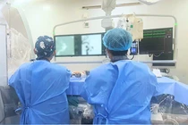 Stent chuyển dòng cứu người bệnh 50 tuổi bị phình lớn mạch máu não