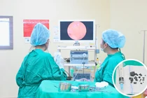 Xoang bị nấm bám kín khiến người đàn ông đau đầu dồn dập cả năm