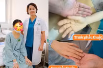 Ê-kíp bác sĩ thót tim vì người phụ nữ mất 3/4 lượng máu trong cơ thể do u xơ