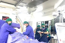 Đặt máy tạo nhịp vĩnh viễn cứu cụ 95 tuổi bị đột quỵ não, nhịp chậm phức tạp