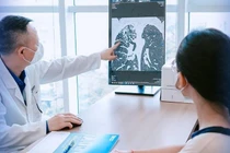 Đau lưng kéo dài, bé gái 15 tuổi phát hiện lao phổi tổn thương mạch máu