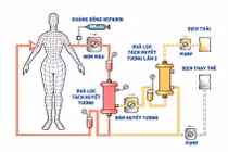 Lọc huyết tương thời điểm vàng loại bỏ yếu tố gây bệnh ra khỏi cơ thể