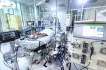 Chỉ sốt, nôn ói trẻ 8 tuổi bị viêm cơ tim tối cấp, sốc tim nguy kịch