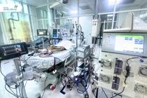 Chỉ sốt, nôn ói trẻ 8 tuổi bị viêm cơ tim tối cấp, sốc tim nguy kịch