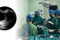 Đau vùng chậu thiếu nữ 28 tuổi mắc u nang ống Muller bẩm sinh hiếm gặp