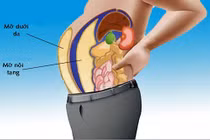 Những thói quen gây tích mỡ bụng, mỡ nội tạng