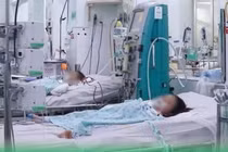 Trẻ sốt xuất huyết men gan tăng gấp 100 lần, sốc nặng