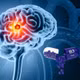 Phát hiện Vitamin B3 có tiềm năng hỗ trợ điều trị ung thư não glioblastoma
