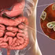 Công nghệ probiotic biến đổi gene mở ra tương lai điều trị tiểu đường