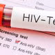 Công nghệ enzyme CRISPR mới giúp phát hiện HIV nhanh và chính xác hơn
