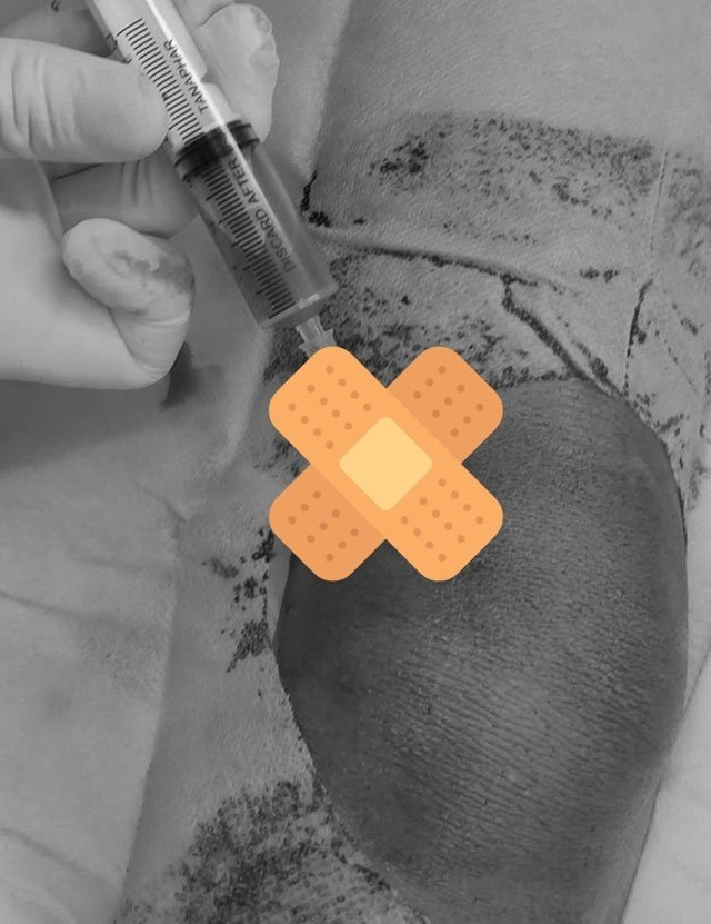 Các bác sĩ can thiệp điều trị cho trẻ. Ảnh: BVCC.