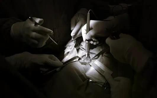 Phẫu thuật triệt căn và nạo vét sạch hạch theo bản đồ hạch lập trước mổ. Ảnh BV